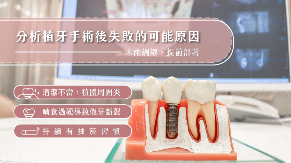 耀美牙醫-植牙失敗原因
