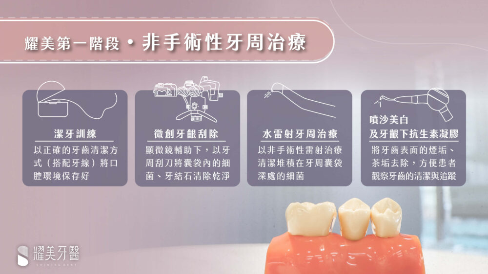 非手術牙周治療，耀美第一階段牙周療程
