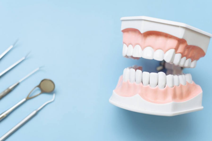植牙傷口癒合時間要多久？