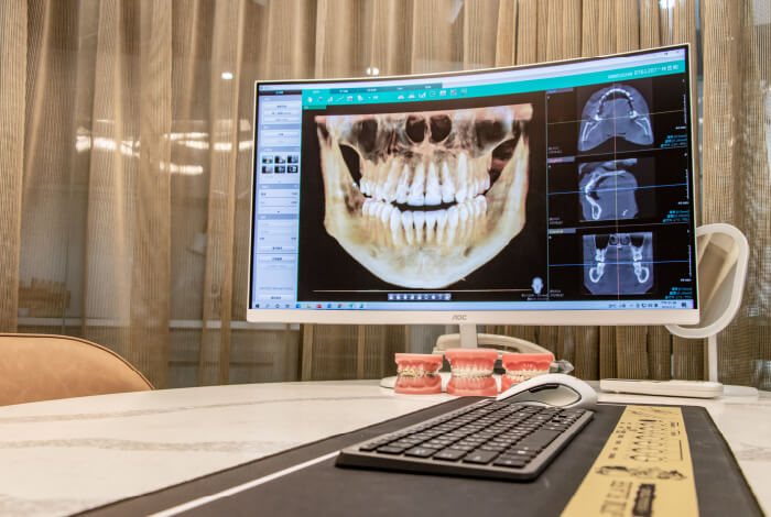 耀美牙醫CT斷層掃描評估口腔地基、骨頭情況
